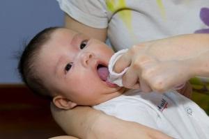 white coating on the tongue of an infant