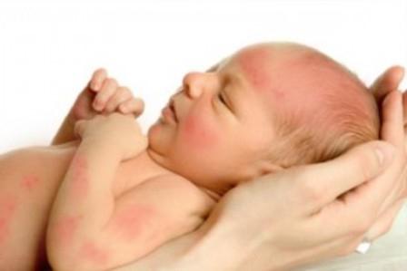 skin diseases in the child