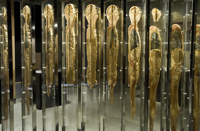 Anatomical exhibition "Secrets of the Body" opens the door to the "Universe Inside" of each of us