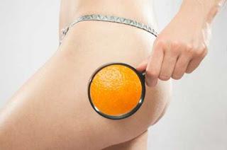 A few words on how to remove cellulite from the thighs and buttocks at home