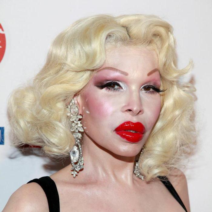 Amanda Lepore: life model before and after surgery