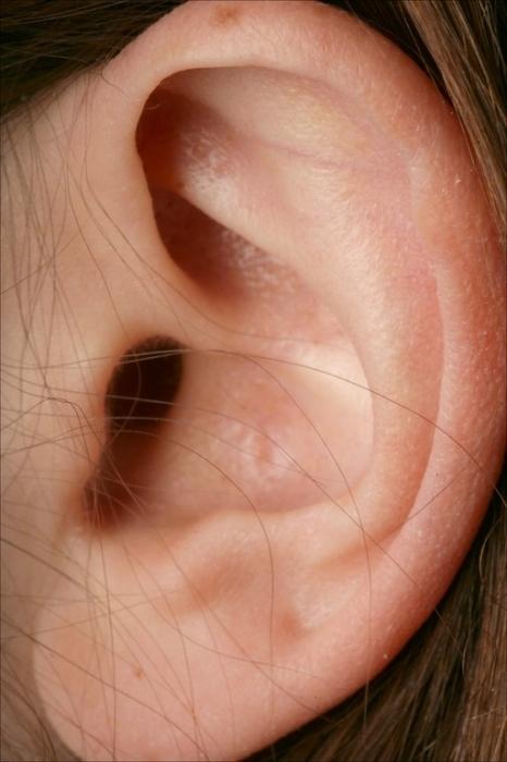 What should I do if I have laid my ears after a cold?