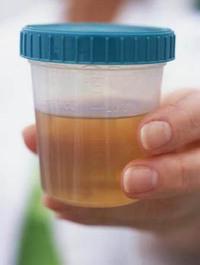 If a protein in the urine is found, what does it mean?
