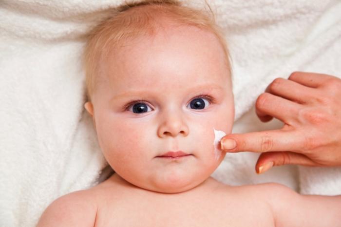 How is the treatment of atopic dermatitis in a child?