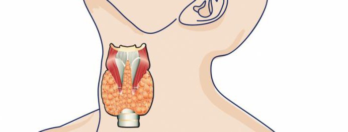 autoimmune thyroiditis with nodulation treatment of folk remedies 