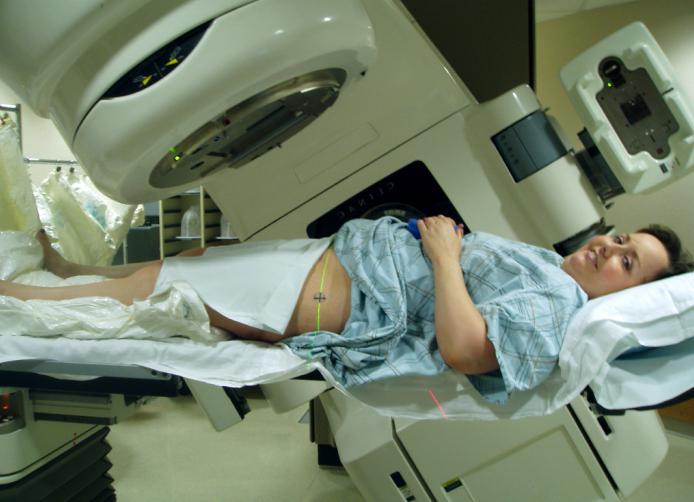 radiation therapy of tumors