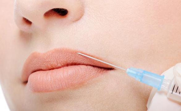 Lips are missing: the reasons. Nemeth tongue and lips: causes, treatment