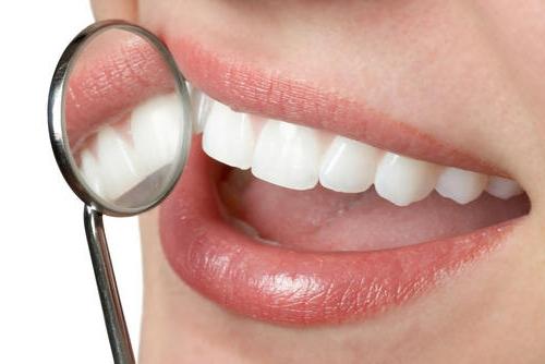 Teeth whitening: expert reviews and recommendations
