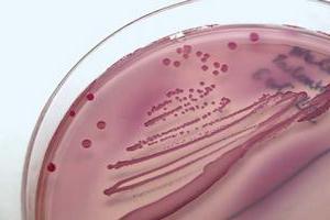 Where does Escherichia coli go from the urine?