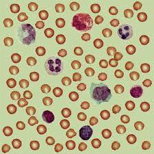 Why are white blood cells low?