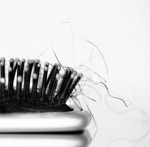 hair loss in men 