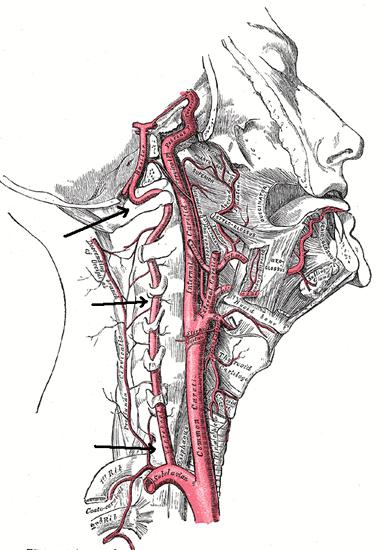 left vertebral artery