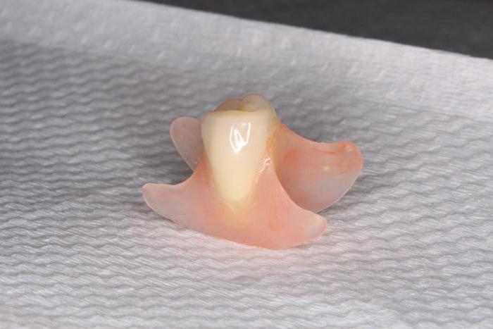 Options for replacement of teeth. Dental Prosthetics